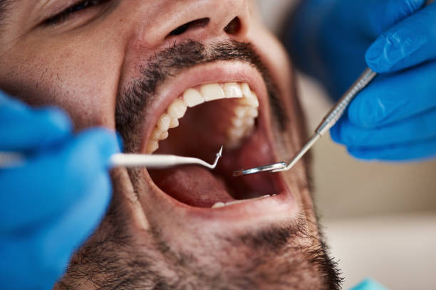 Best TMJ/TMD Treatment  in Sweet Springs, MO